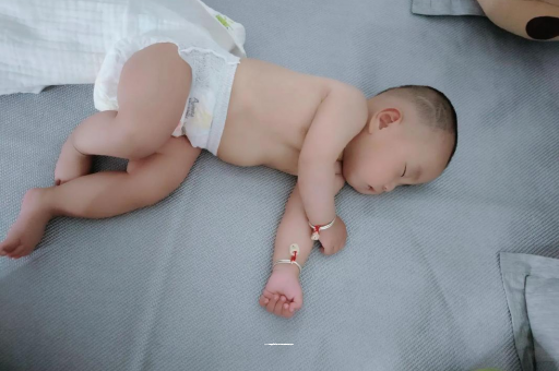萍乡六个月宝宝眼睛散光